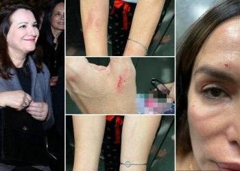 Policija privela Severinu, izvor blizak pjevačici: ‘Sestra ju je napala i lažno prijavila‘