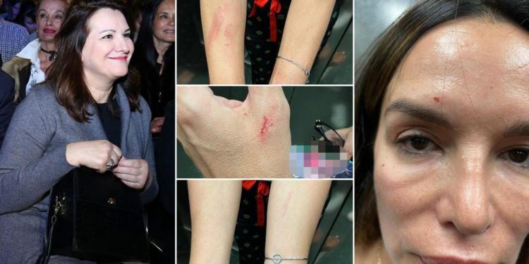 Policija privela Severinu, izvor blizak pjevačici: ‘Sestra ju je napala i lažno prijavila‘