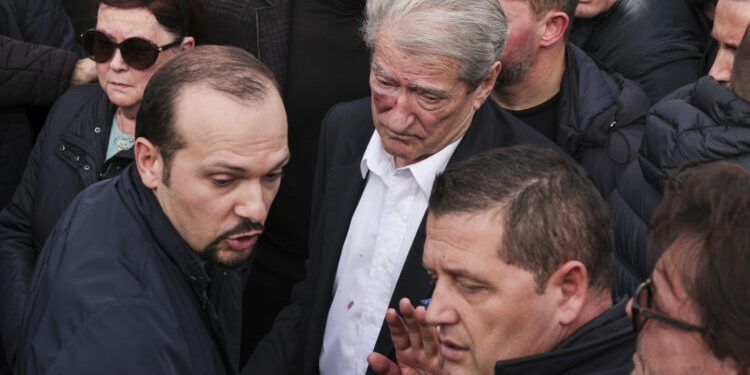 (VIDEO) Salji Beriša napadnut tokom protesta u Tirani